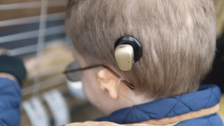 10 Best Bone Conduction Hearing Aids (2026)