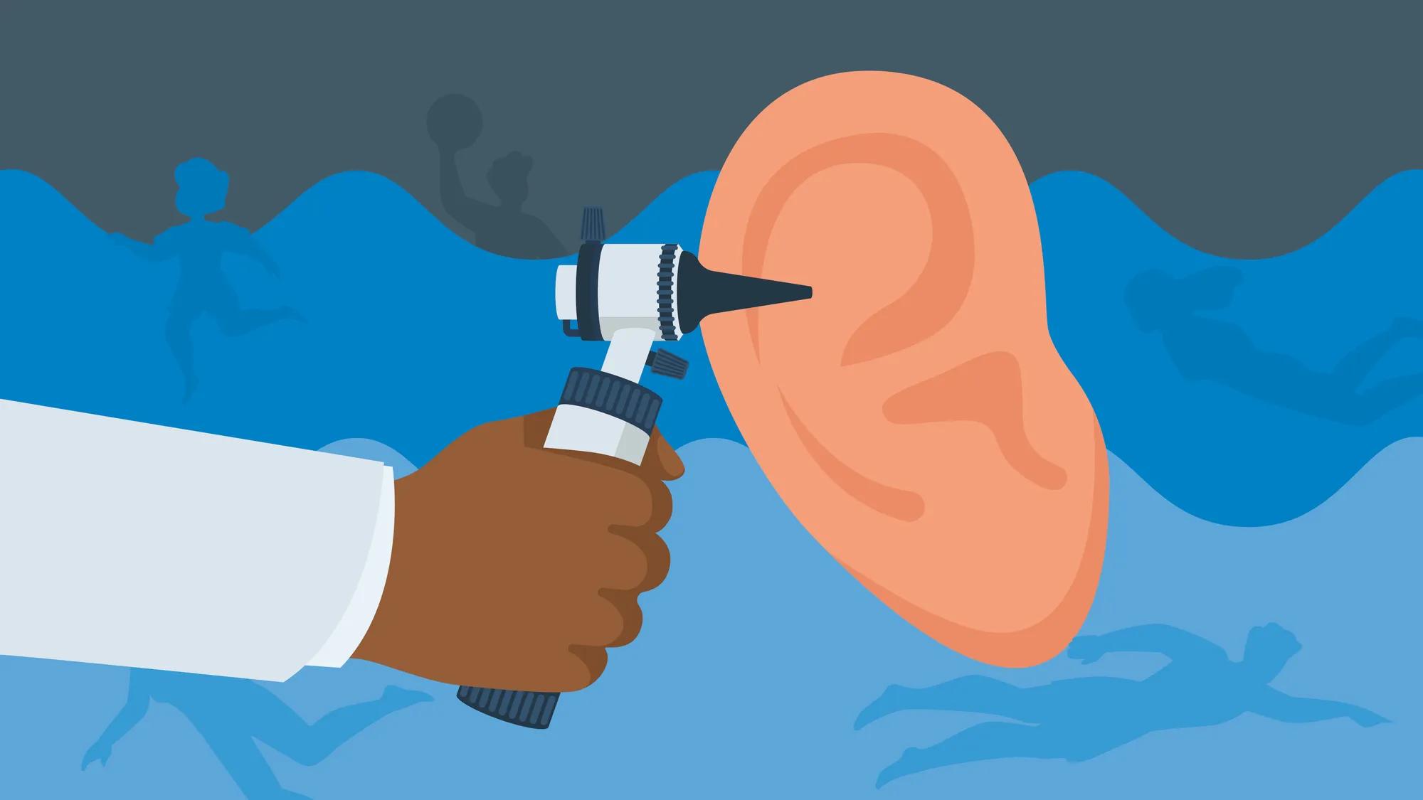 Best way to clean ears